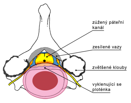 Zpět